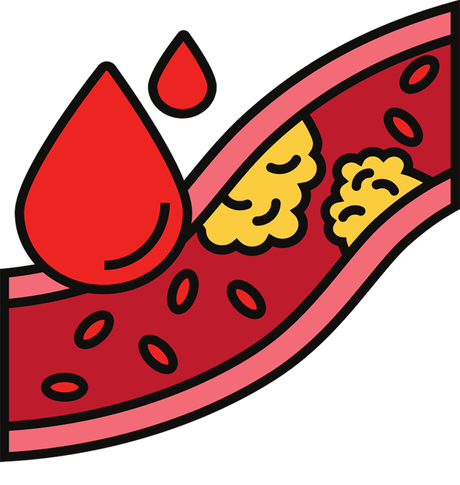 High Cholesterol